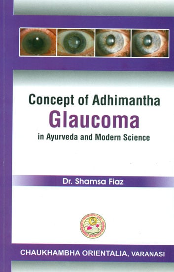 Concept of Adhimantha: Glaucoma in Ayurveda and Modern Science