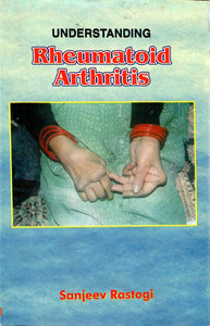 Understanding Rheumatoid Arthritis