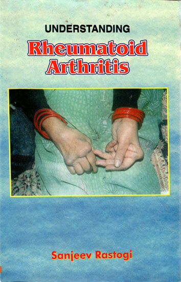 Understanding Rheumatoid Arthritis