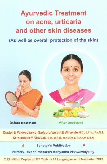 Ayurvedic Treatment On Acne, Urticaria and Other Skin Disease (As Well as Overall Protection of the Skin)